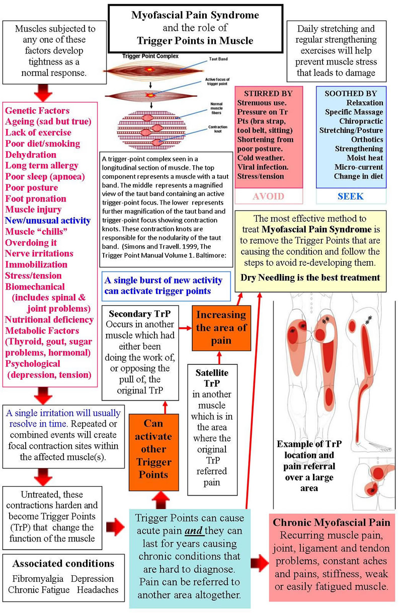 Therapy Trigger Points Chart